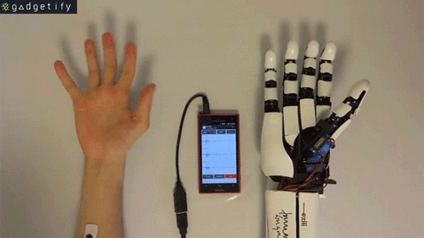 bionic-arm-gadgetify