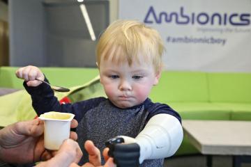 Ambionics’ 3D Printed Hydraulic Prosthetic Arm for Children