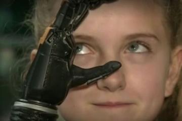3D Printed Bionic Hands for Children