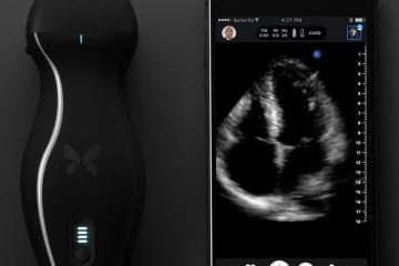 Butterfly iQ: Ultrasound On Your Smartphone