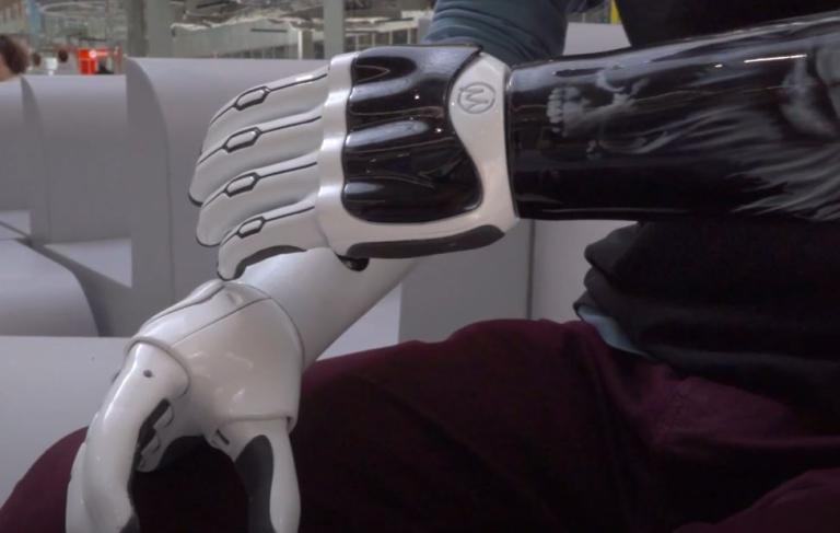 INDY Hand Bionic Prosthetic Hand