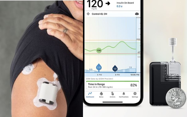 Tandem Mobi Wearable Automated Insulin Delivery System